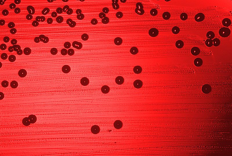 Doctors Gates Clinical Symptoms Of Haemophilus Influenzae Vs