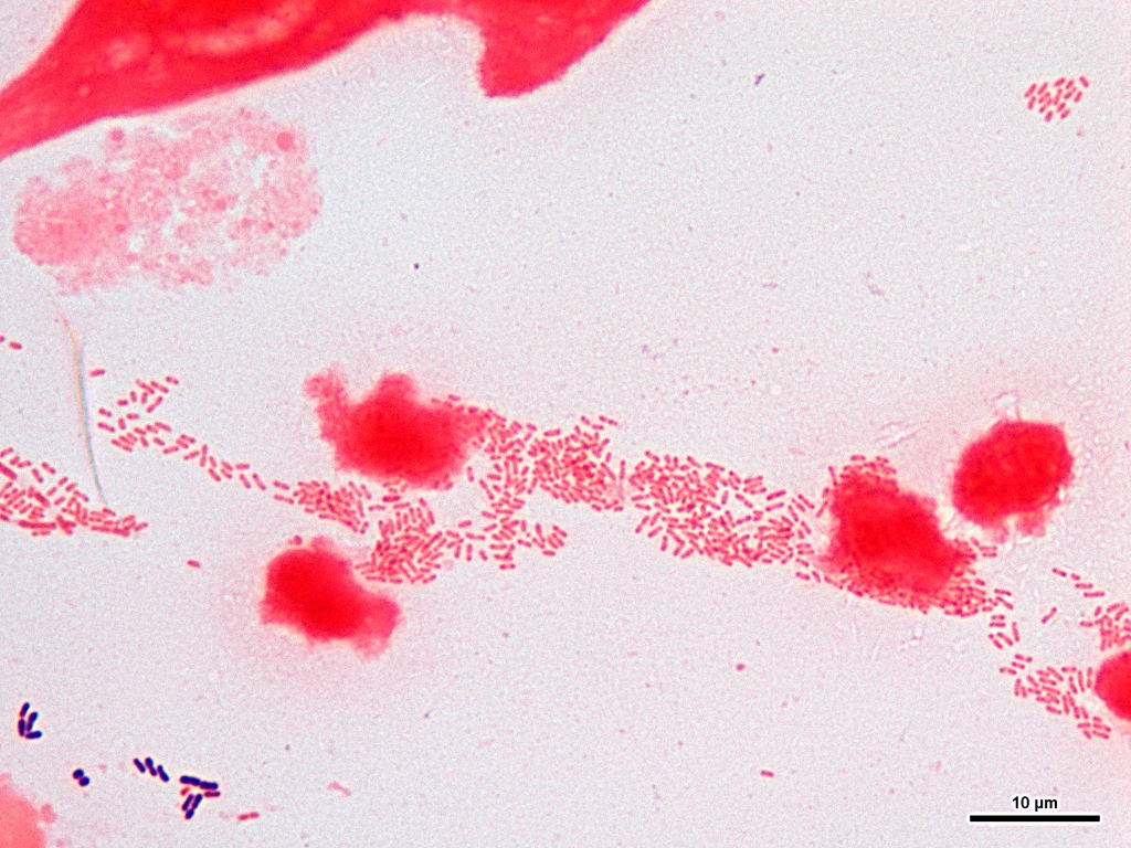 Haemophilus Influenzae Picture Gram Stain